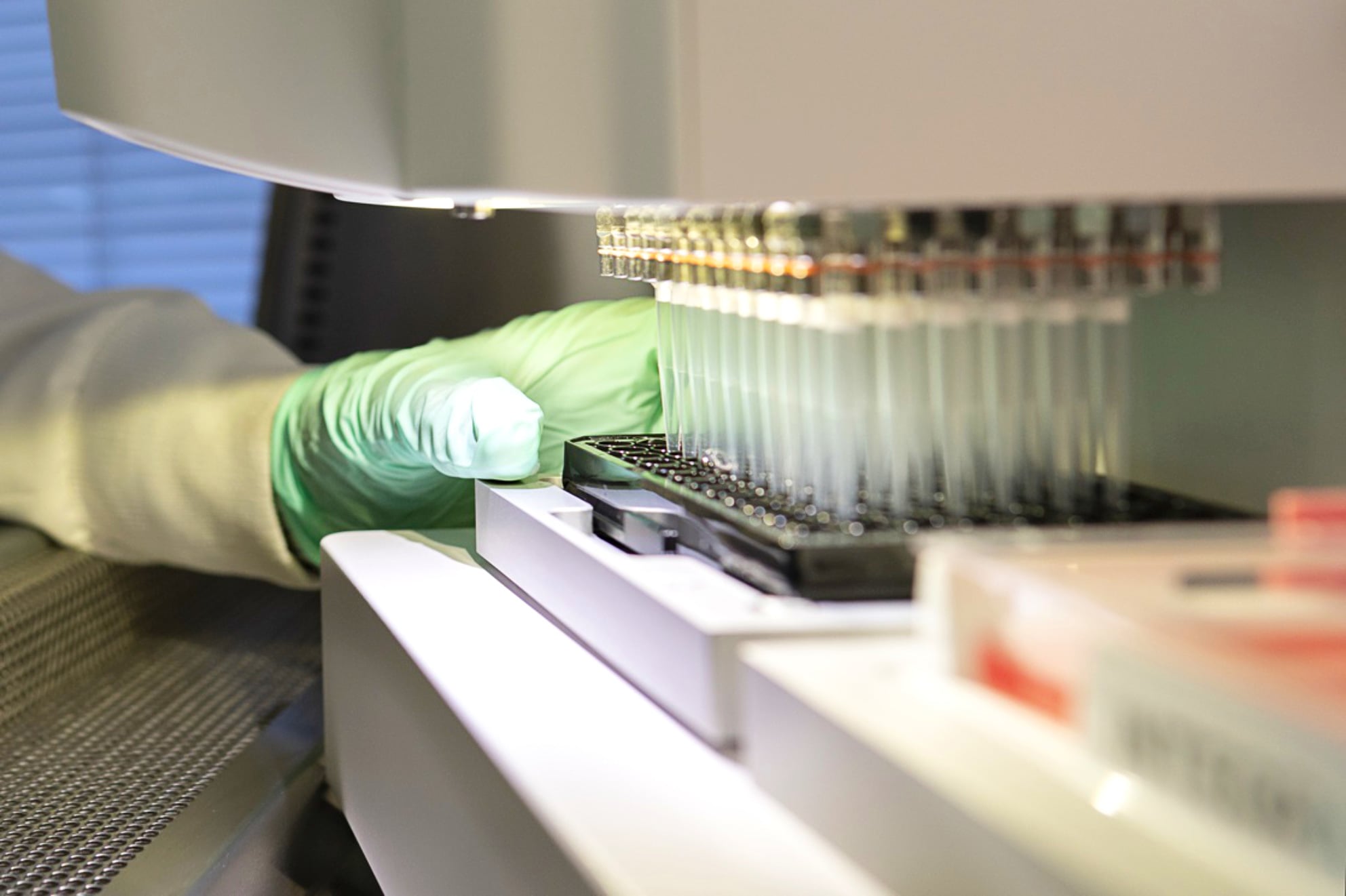 EU autorizó un tratamiento contra el Alzheimer, llamado Aduhelm. La Jornada