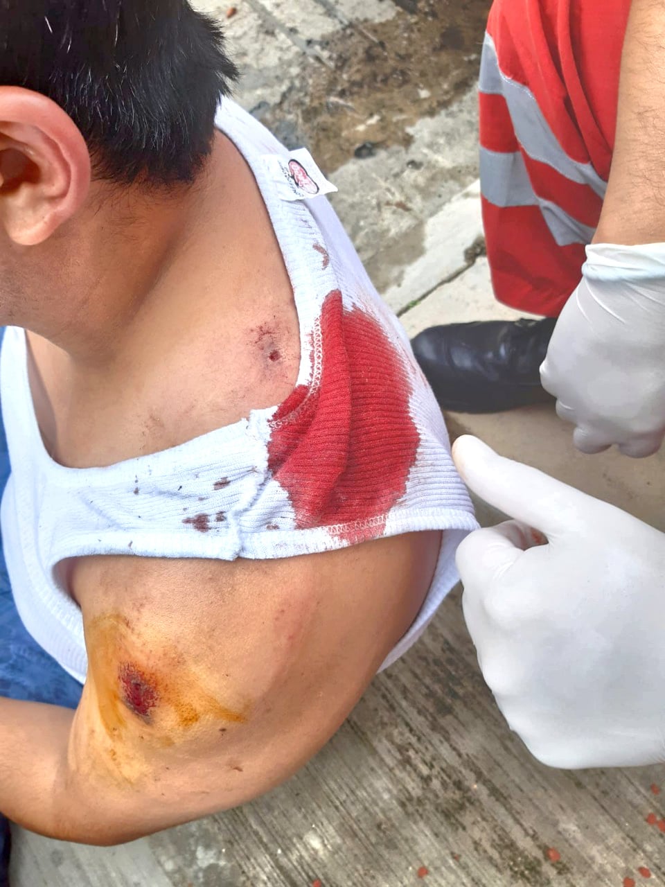 Uriel salvó la vida, pues solamente sufrió una lesión en el hombro.
