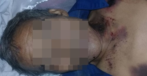 Otro hombre murió al ser atacado a balazos luego de acudir a la festividad de San Miguel Arcángel.