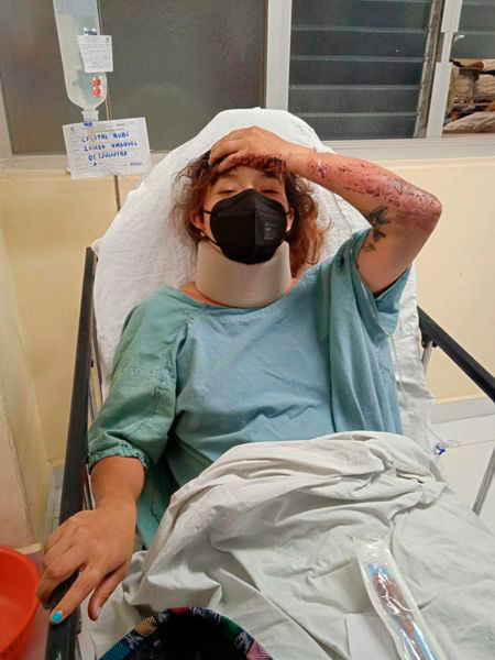 La ciclista atropellada se encuentra ingresada en el Hospital Civil.