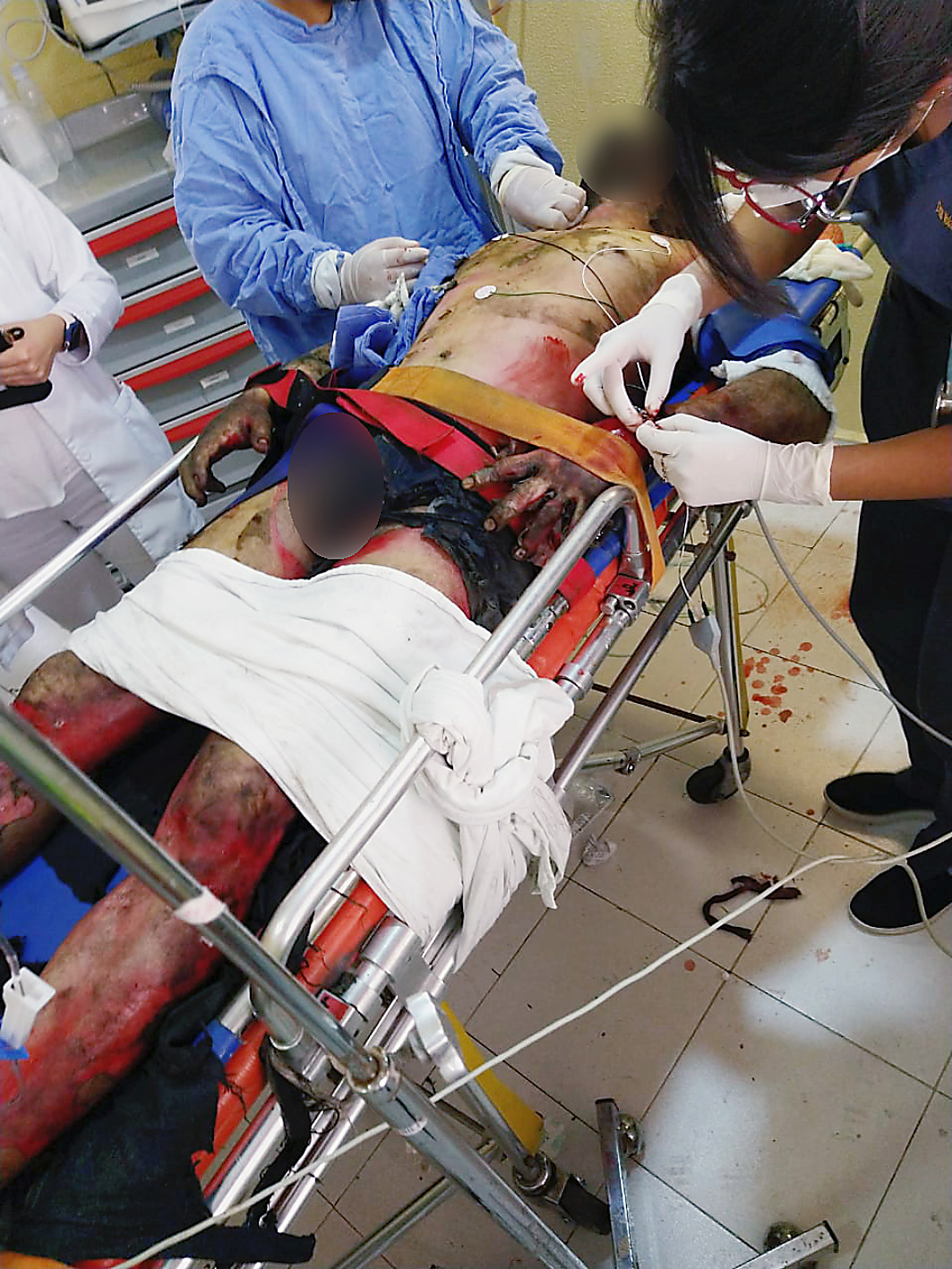 Arnold, de 36 años, murió al resultar con quemaduras de tercer grado en todo el cuerpo.