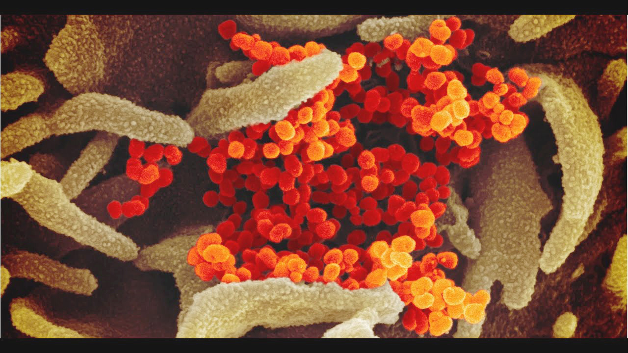 Las variaciones en los virus suceden por procesos naturales llamados mutaciones.