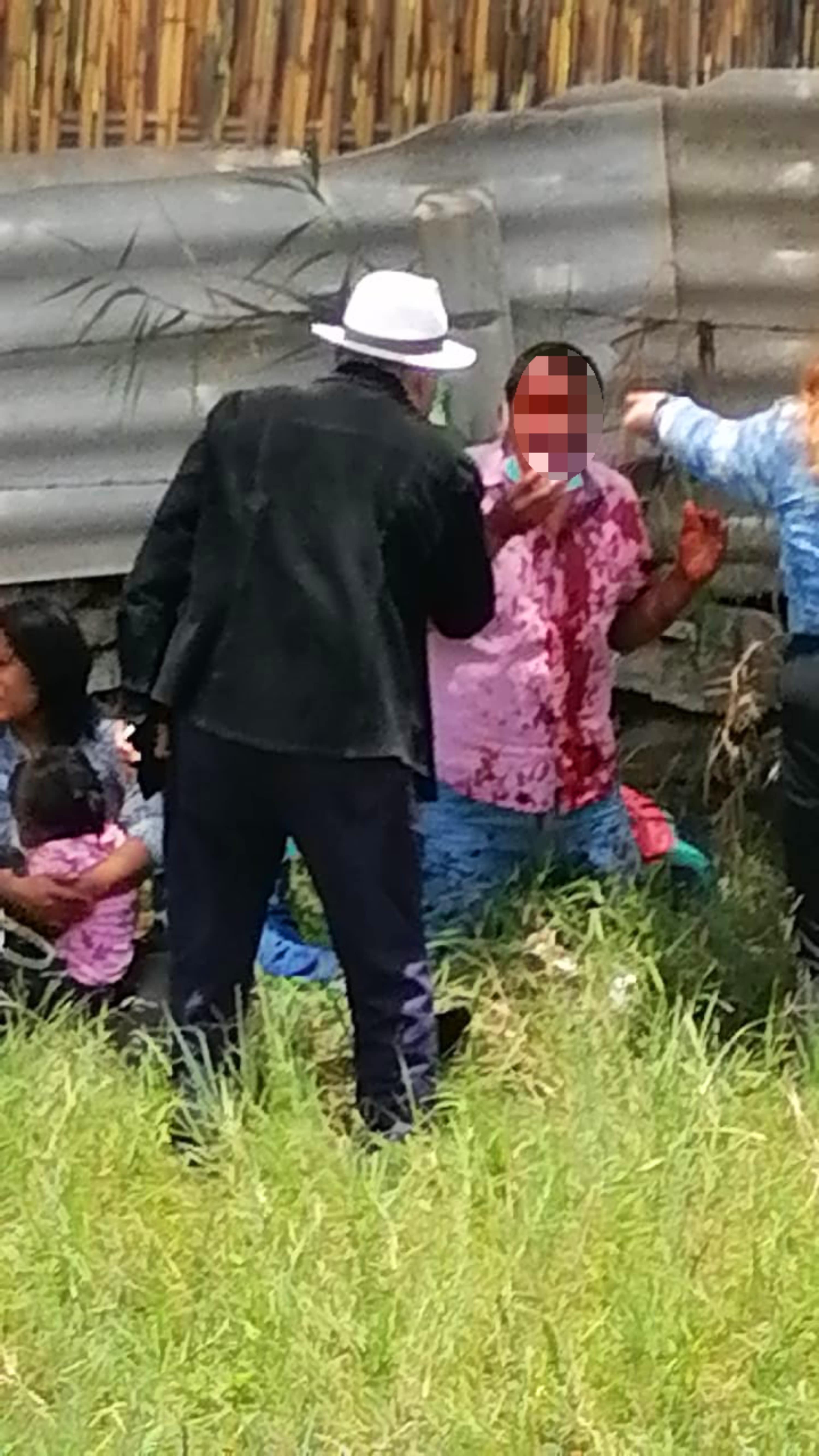 Una persona ensangrentada fue auxiliada por paramédicos.