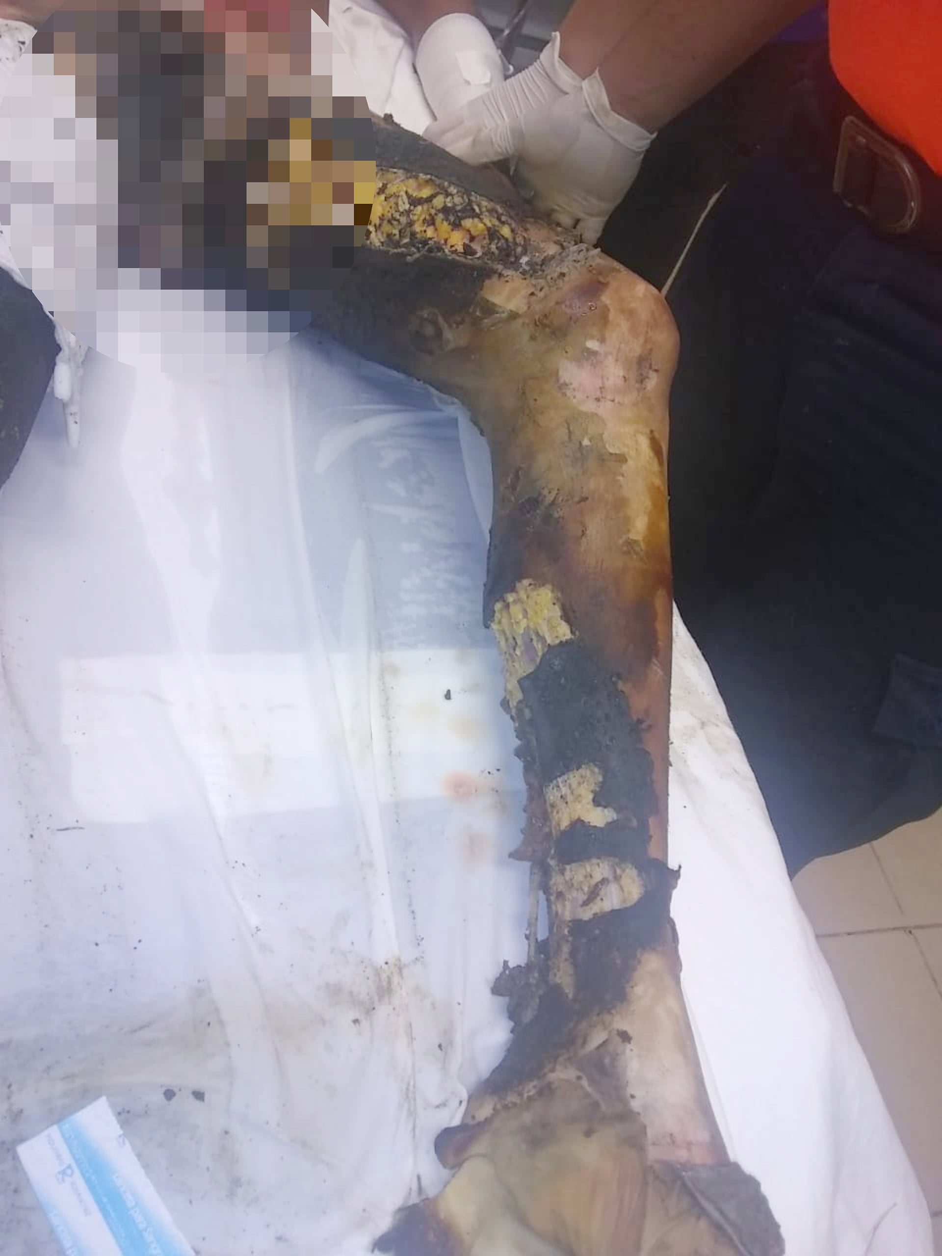 Dos personas fallecieron quemadas en un accidente.