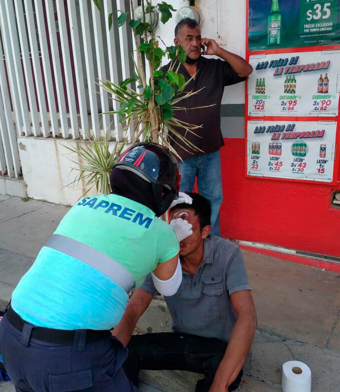 Jorge, de 21 años, fue golpeado por dos cholos.