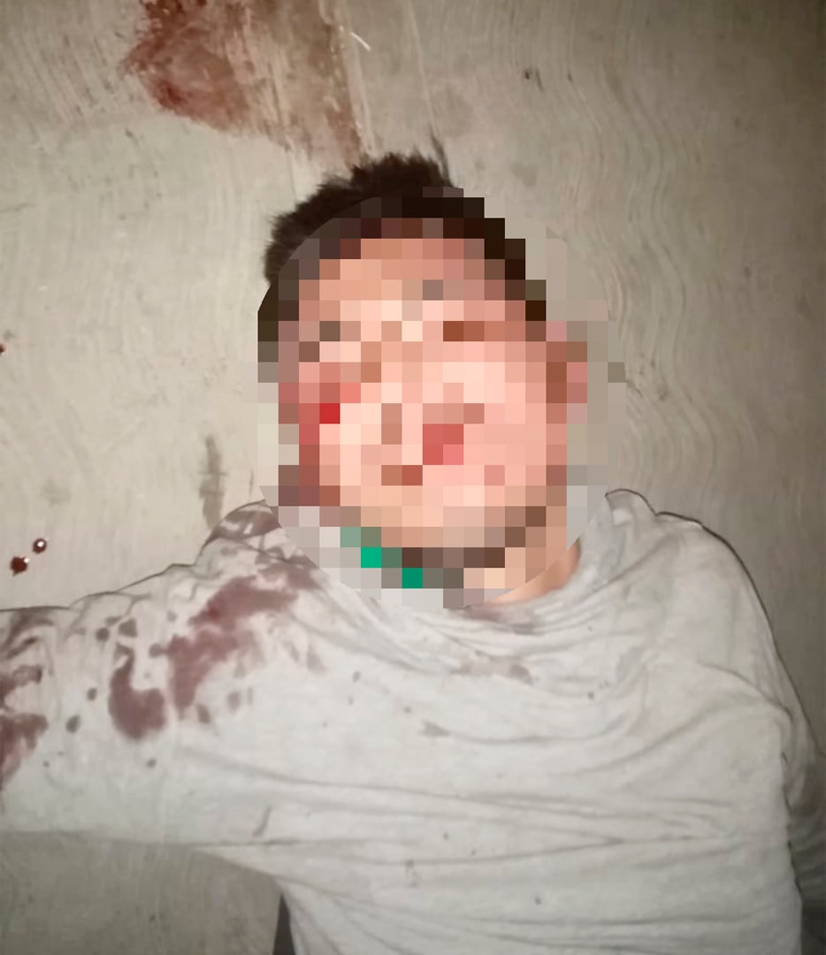 Adrián, de 27 años, fue golpeado por los vecinos.