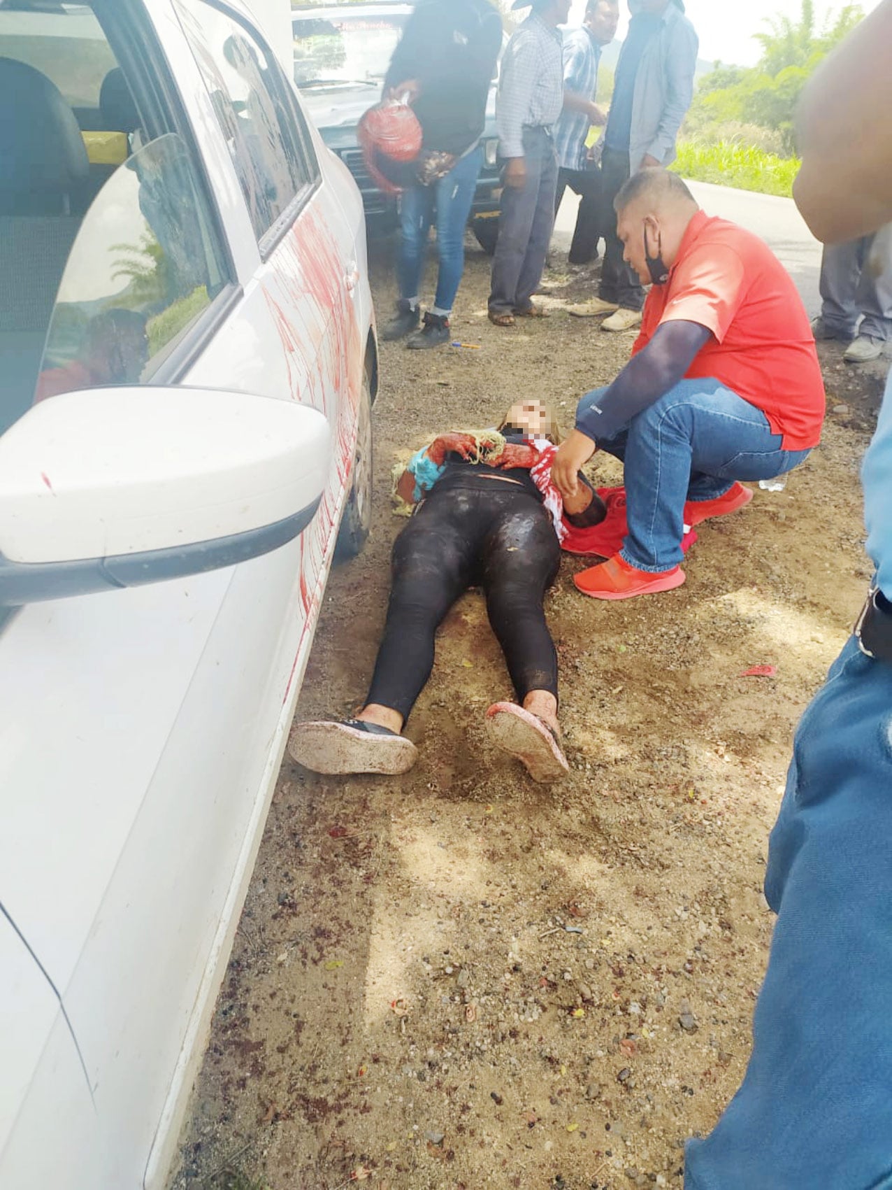 Una pareja fue auxiliada al tener lesiones en las venas de las manos.